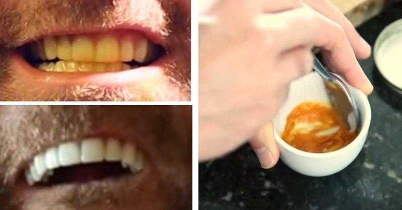 Homem clareia os dentes com um truque absurdamente simples. Veja!!