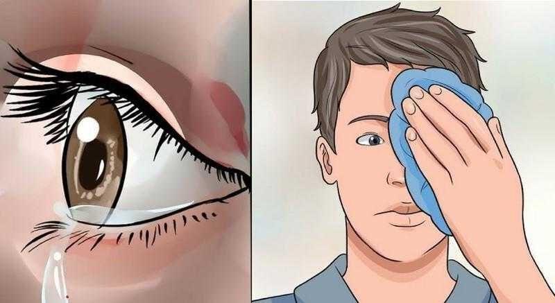 7 Remédios caseiros para coceiras nos olhos