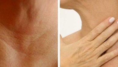 Tratamentos naturais para prevenir o surgimento de rugas no pescoço e nas mãos