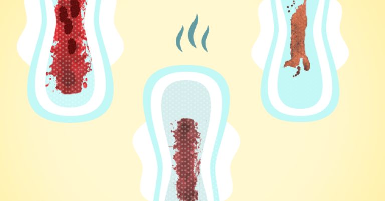 12 tipos de menstruação e o que eles dizem sobre sua saúde 5r