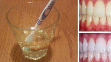 Como clarear os dentes com vinagre de maçã