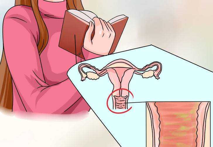 Remédios Caseiros Para Vaginite