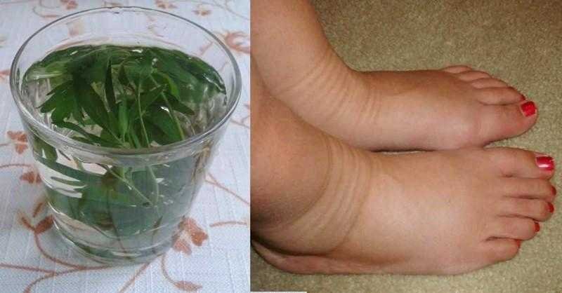 6 remédios caseiros para aliviar a dor e o inchaço nas pernas