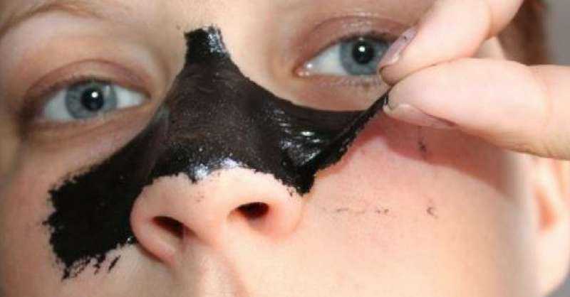 Máscara de carvão caseira para eliminar cravos