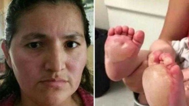Bebê fica com bolhas enormes em seus pés. Mas depois, sua mãe descobre o que a babá horrível fez!