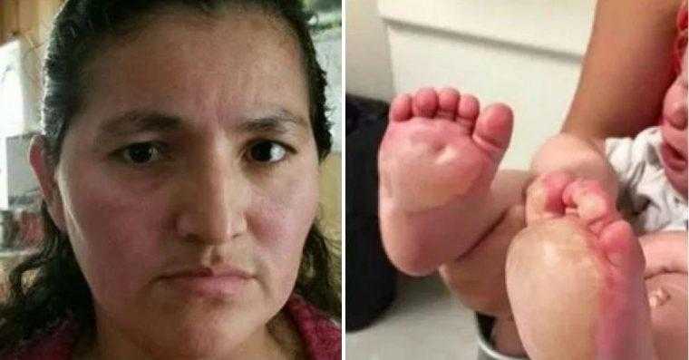 Bebê fica com bolhas enormes em seus pés. Mas depois, sua mãe descobre o que a babá horrível fez!