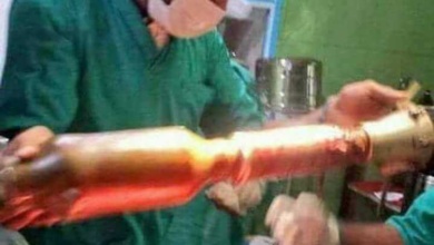 Médicos retiram míssil que estava preso nas nádegas de paciente