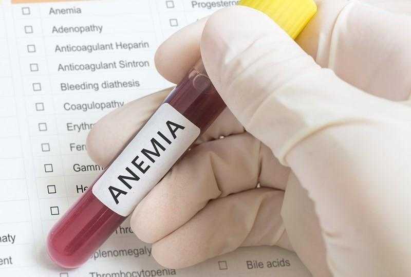 Melhores remédios caseiros contra a anemia