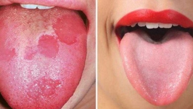 8 Sinais que sua língua dá e que podem dizer bastante sobre a sua saúde