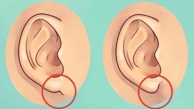 O que suas orelhas dizem sobre sua saúde