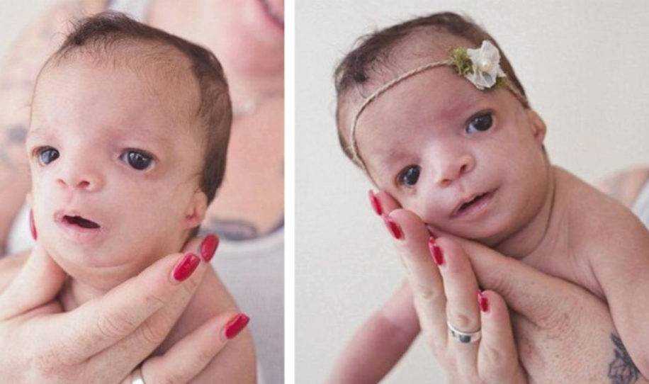Família adotiva foge do hospital ao ver a cara da bebê te