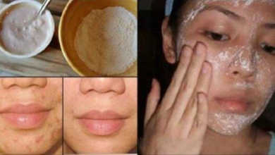 Máscara facial para tratar acne e cicatrizes a
