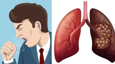 Conheça 8 sinais de alerta de câncer no pulmão