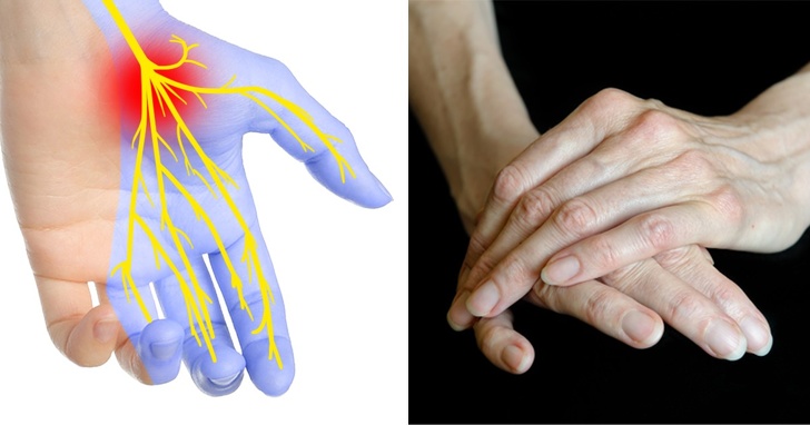 7 Coisas que as mãos podem revelar sobre sua saúde