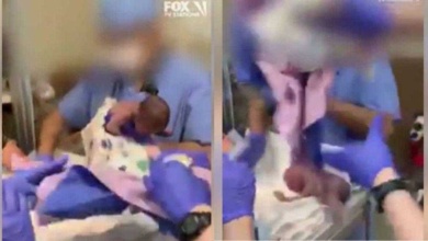 Pai mostra bebê 3 meses após ter sido derrubada pelo médico ao nascer