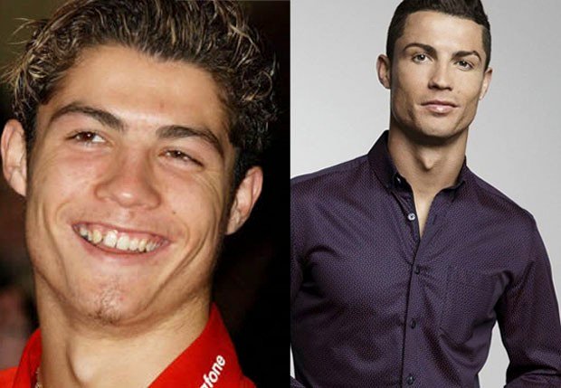 Cristiano Ronaldo antes e depois (Foto: Reprodução/Instagram)