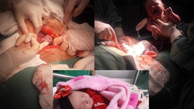 Ao abrir barriga em cesárea, bebê segura dedo de médica e emociona equipe e famíli