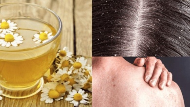 13 benefícios do chá de camomila para a pele, cabelo e saúde geral