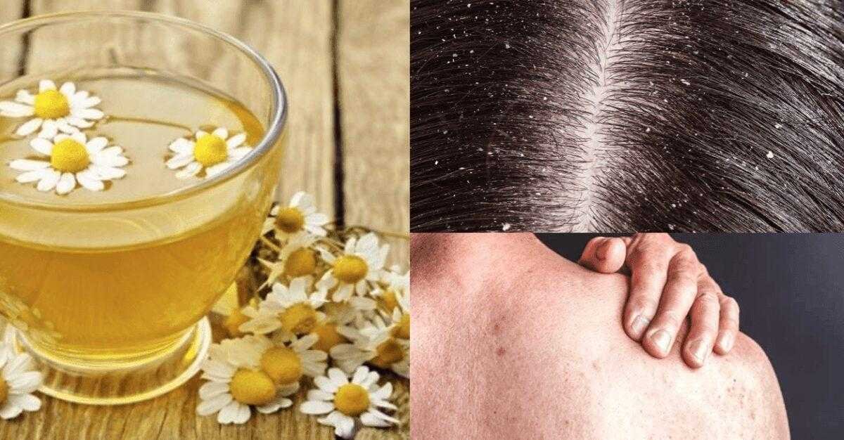 13 benefícios do chá de camomila para a pele, cabelo e saúde geral