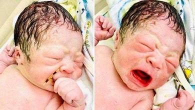 Bebê nasce segurando o DIU e surpreende a equipe médica