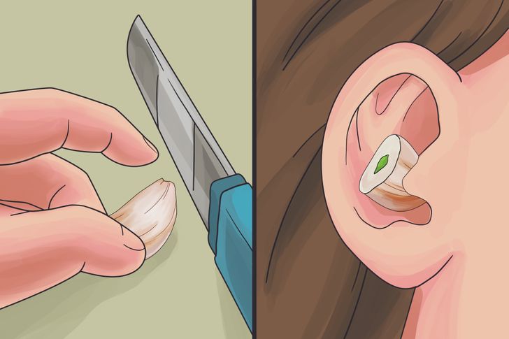 O que acontece quando você coloca um dente de alho no ouvido