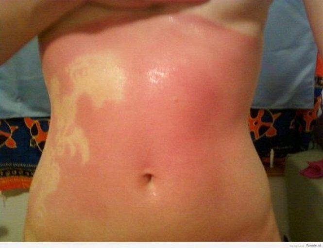 17 Pessoas que esqueceram o quanto as marcas de sol podem ser constrangedoras  aa
