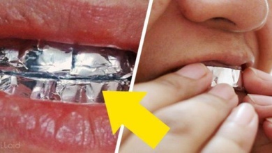 Dentes branquinhos com papel alumínio