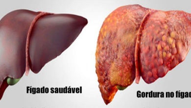 Alimentos que são ruins para o fígado