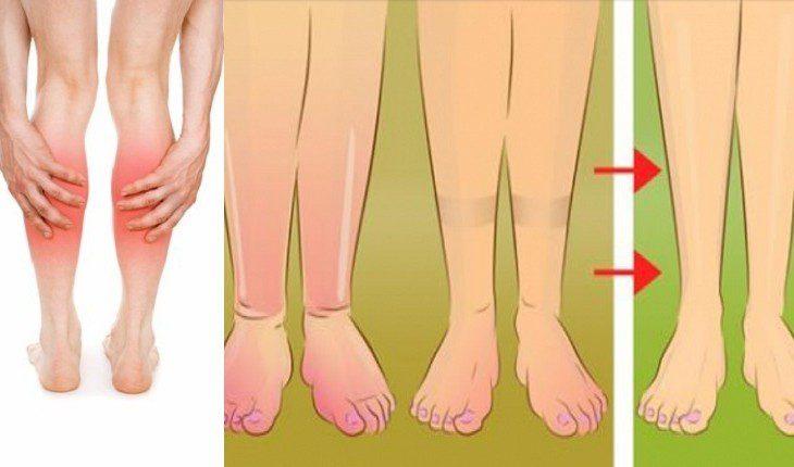 10 Tratamentos naturais para pernas inchadas