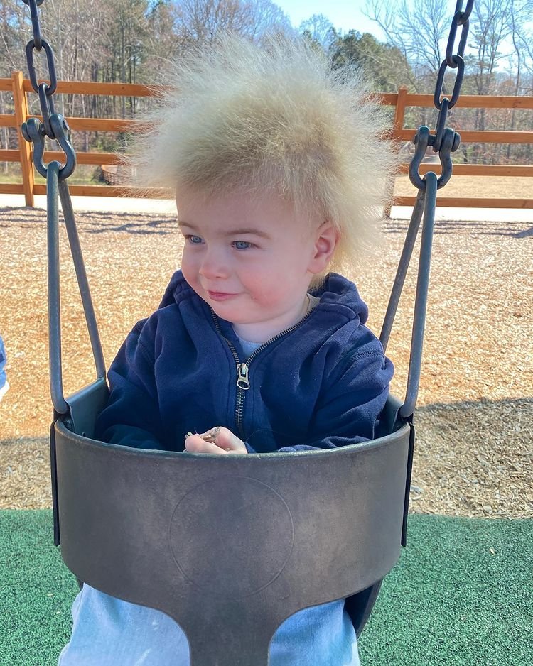 1651032575 509 Menino com Sindrome do Cabelo Impenteavel faz sucesso nas redes