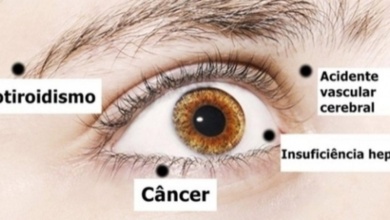 8 coisas que seus olhos dizem sobre a sua saúde