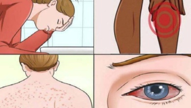 15 Sinais de que você tem a doença do mofo