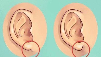 o que suas orelhas dizem sobre sua saúde r