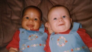 primeiras gêmeas do mundo com cores de pele diferentes já são adultas