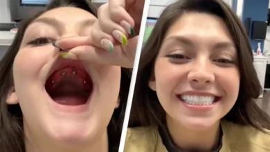 Mulher mostra processo incrível de obtenção de 'novos dentes' que está deixando as pessoas chocadas