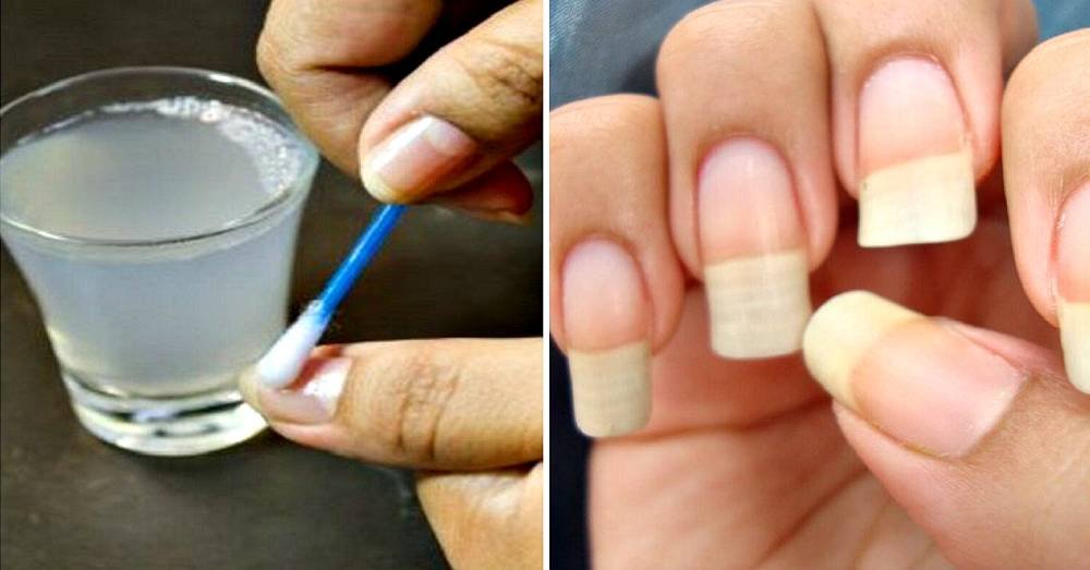 4 receitas caseiras para fazer as unhas crescerem muito mais rápido