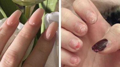 Garota compartilha a realidade sobre usar unhas de acrílico