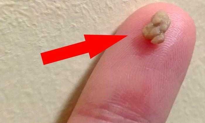 1 em cada 4 pessoas sofrem deste problema que causa mau hálito! Aprenda a corrigi-lo