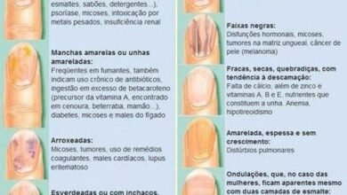 10 Sinais nas unhas que podem indicar problemas graves de saúde