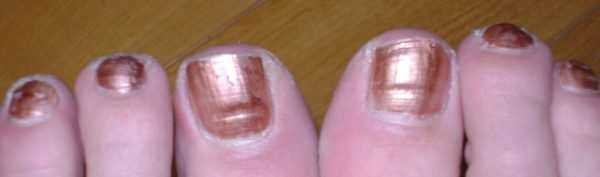 10 alertas que as suas unhas podem te mostrar