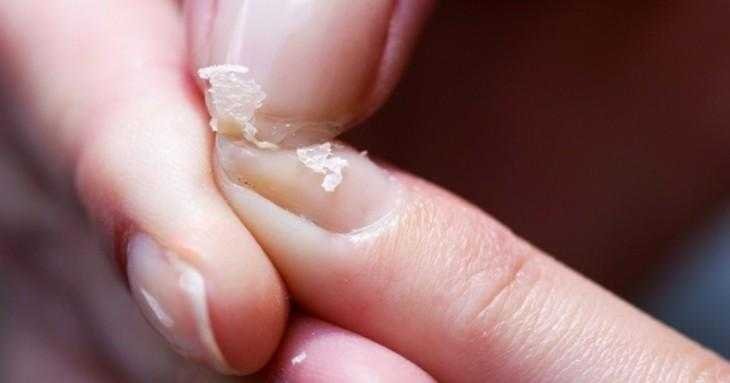 10 coisas erradas que você faz e deixa suas unhas fracas e quebradiças