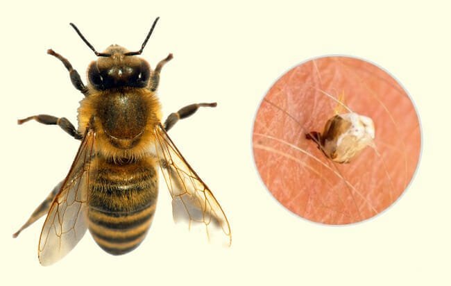 7 Sinais do corpo de um fígado sobrecarregado 1