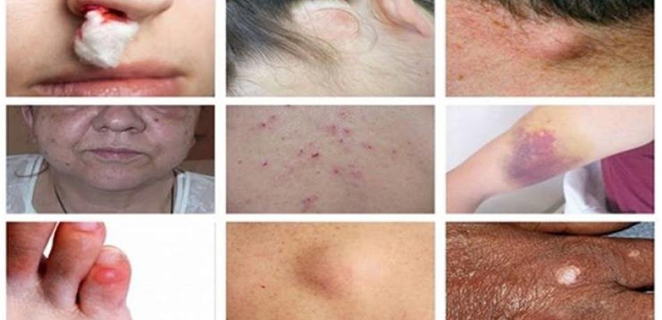 15 Sinais perigosos de câncer que as pessoas ignoram