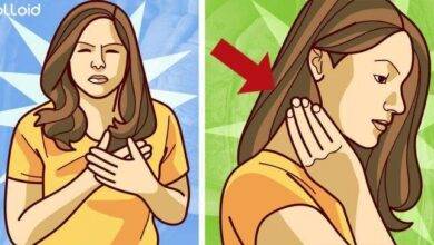 SINTOMAS DE INFARTO