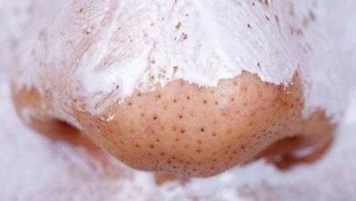 Elimine cravos e espinhas rapidamente com estas 3 receitas caseiras