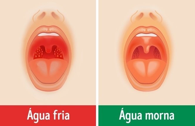Foto: