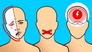 8 avisos do seu corpo antes de um AVC
