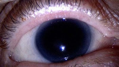 olhos pretos