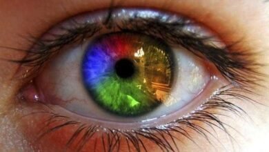 heterocromia