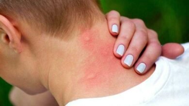 Por que os mosquitos picam mais umas pessoas que outras